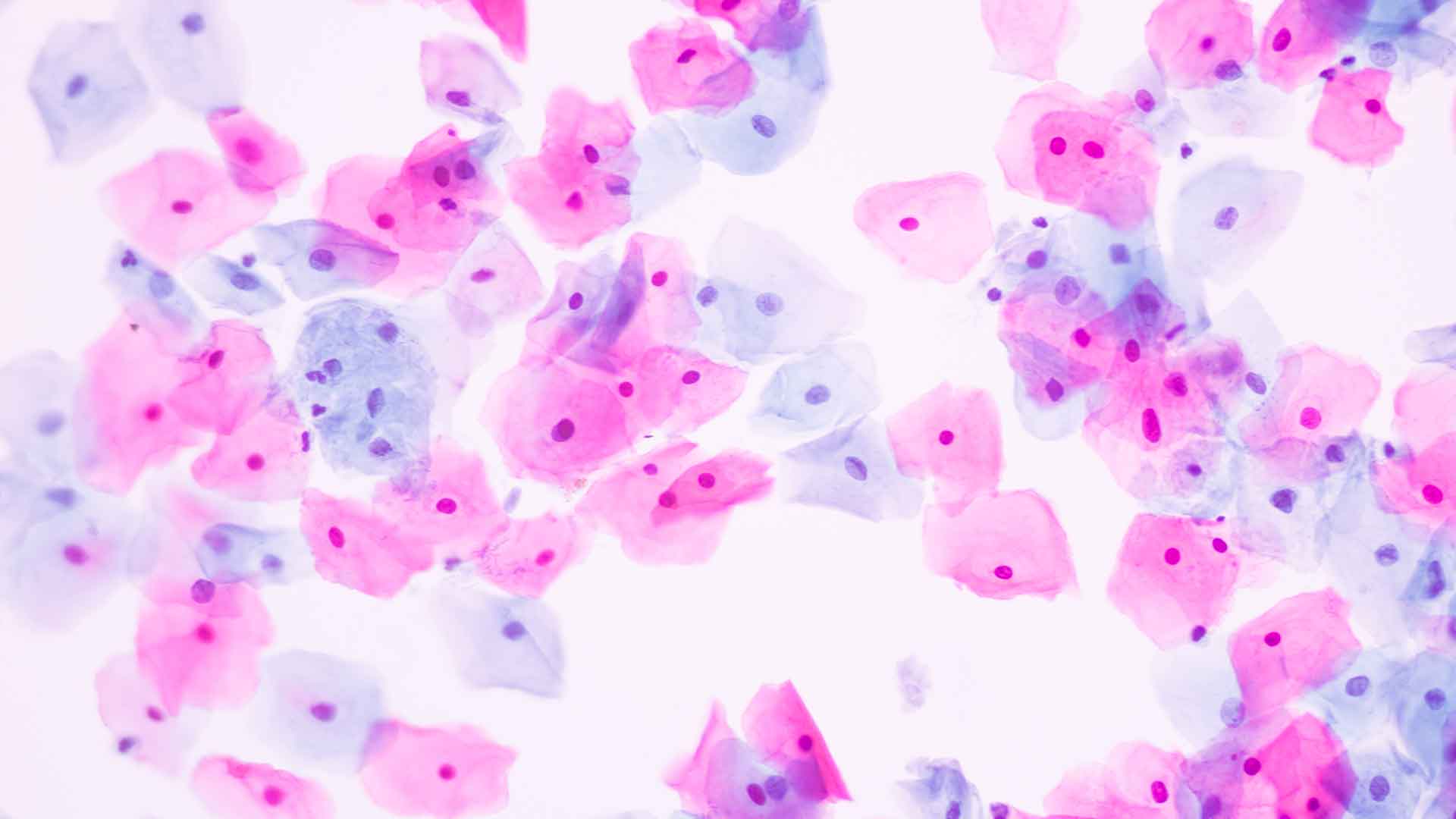 2610 Rhein Sieg Zytologie 1920X1080